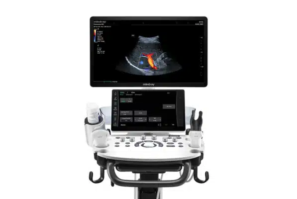 consona-n6-ultrasound-04