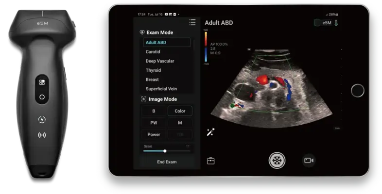 te-air-handheld-ultrasound-system-05_11zon